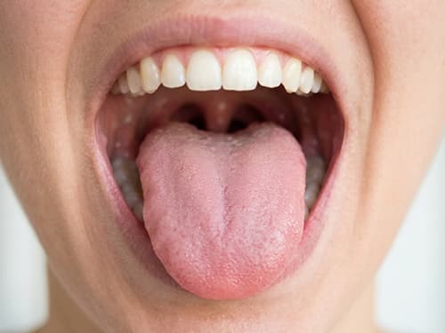 Língua saudável rosa e sem saburra