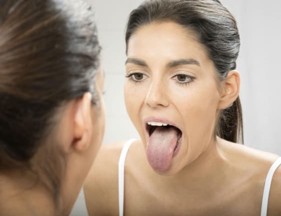 Saburra lingual na superfície da língua